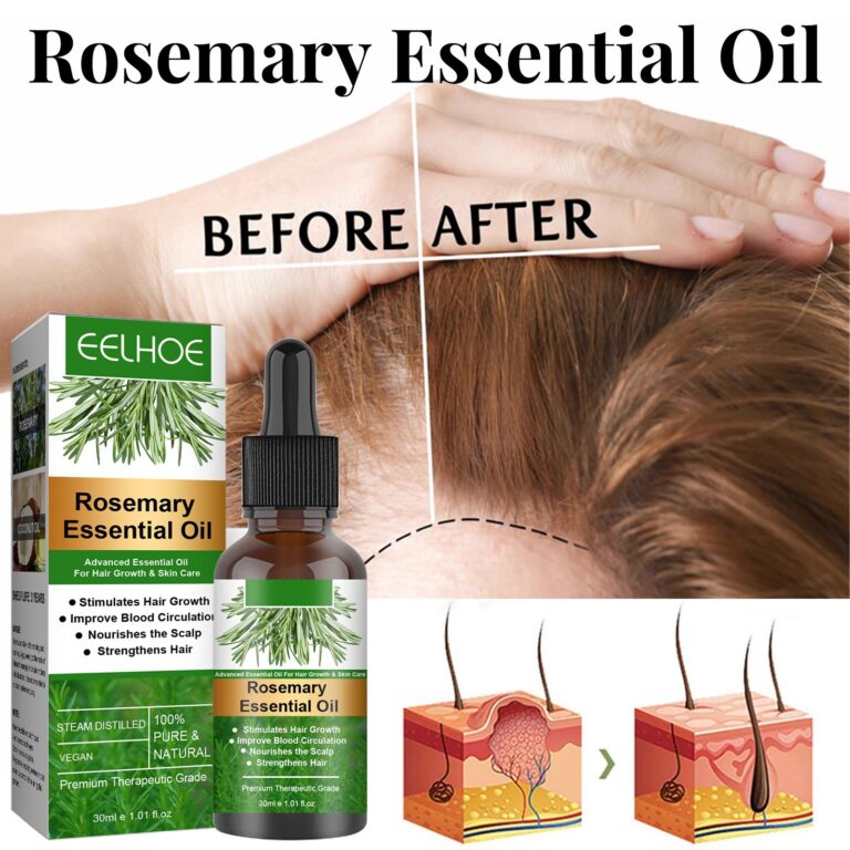 Before andAfter comparison of hair thickness after usin rosemary oil for hair growth